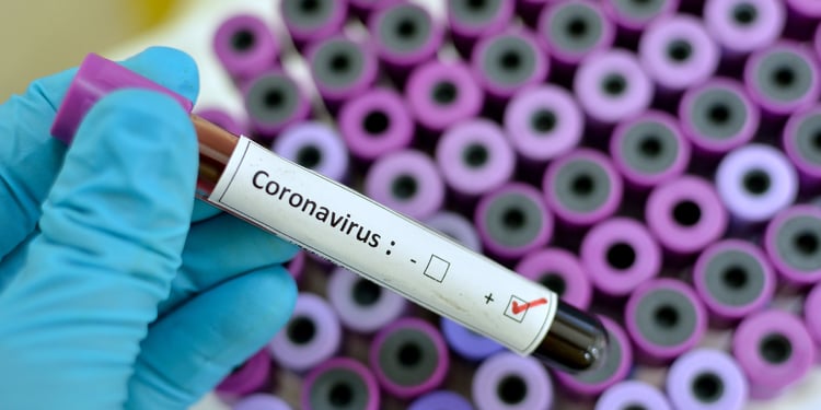 Doctor holding positive coronavirus test
